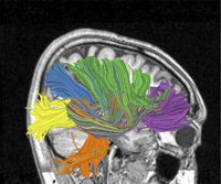 Image from the IBM cognitive computing project.